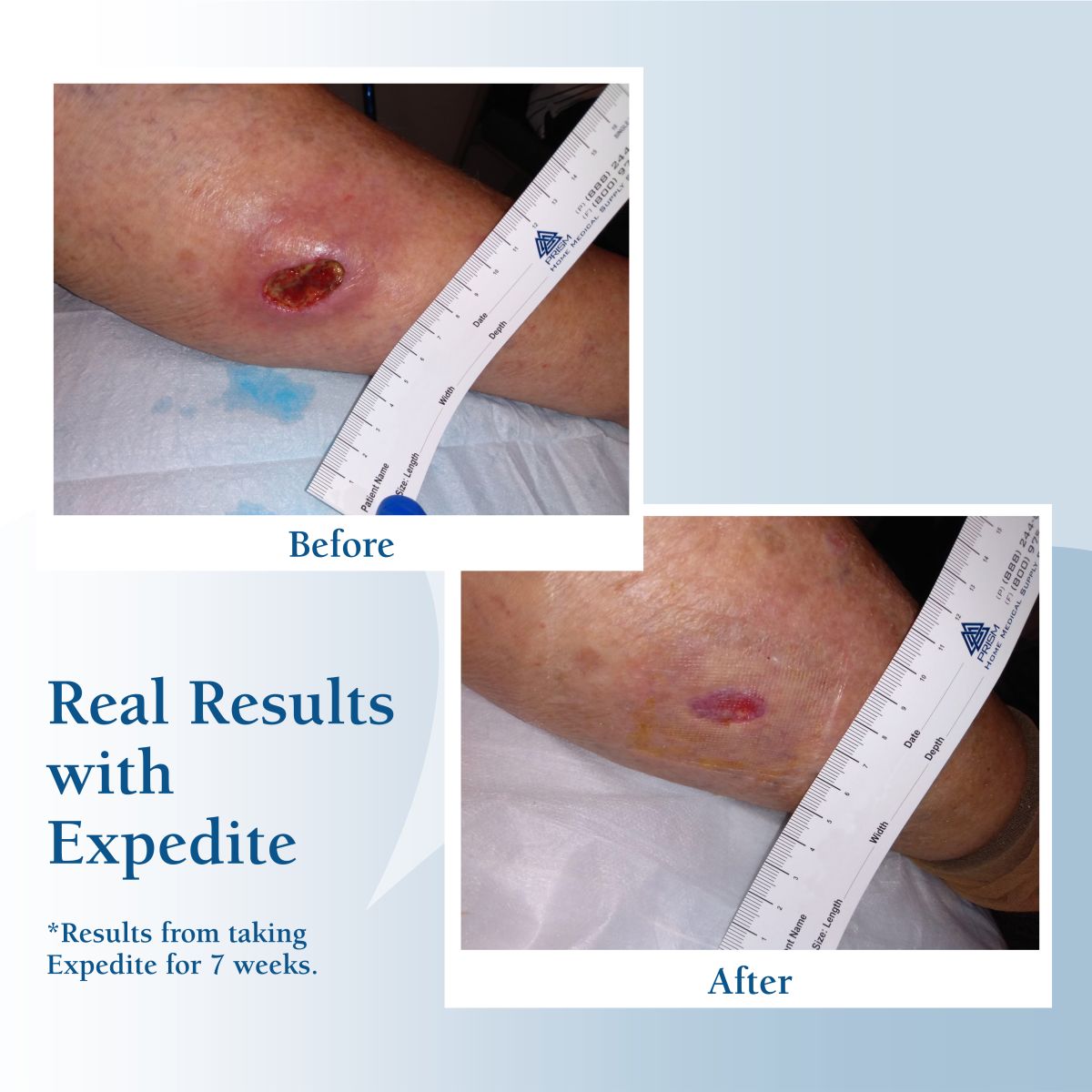 Wound-Results-Photo